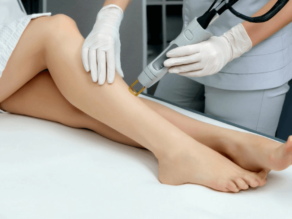 How To Choose An IPL Or Laser Hair Removal Specialist