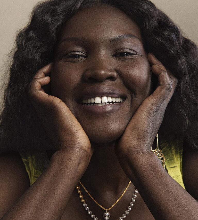 Understanding Hyperpigmentation – How to Correct & Prevent Uneven Skin Tone