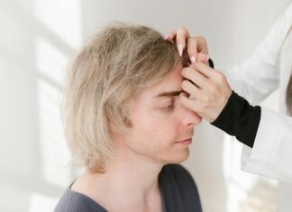 Post-Transplant Redness: How Long It Lasts (and How to Reduce It Faster)